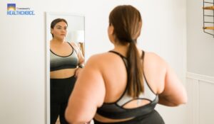 Skin After Losing Weight