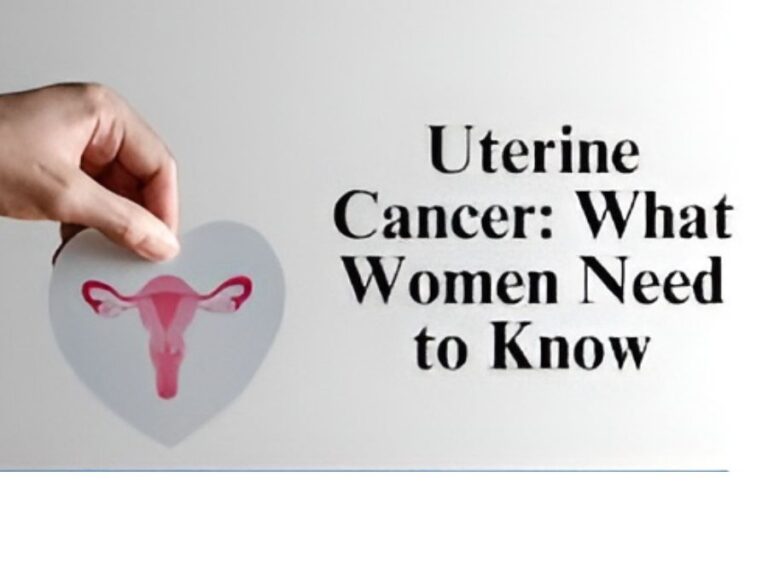 Understanding cancer (endometrial) cancer: The major facts should be known to every woman