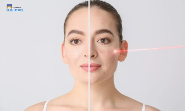 Achieve Flawless-Looking Skin with Targeted Scar Treatments