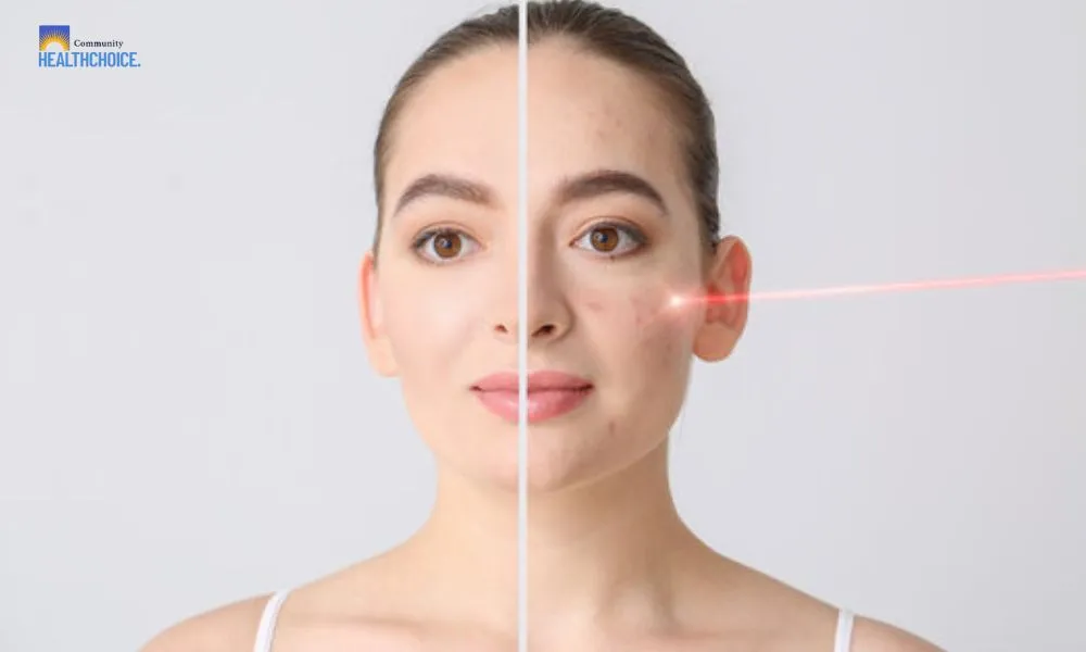 Achieve Flawless-Looking Skin with Targeted Scar Treatments