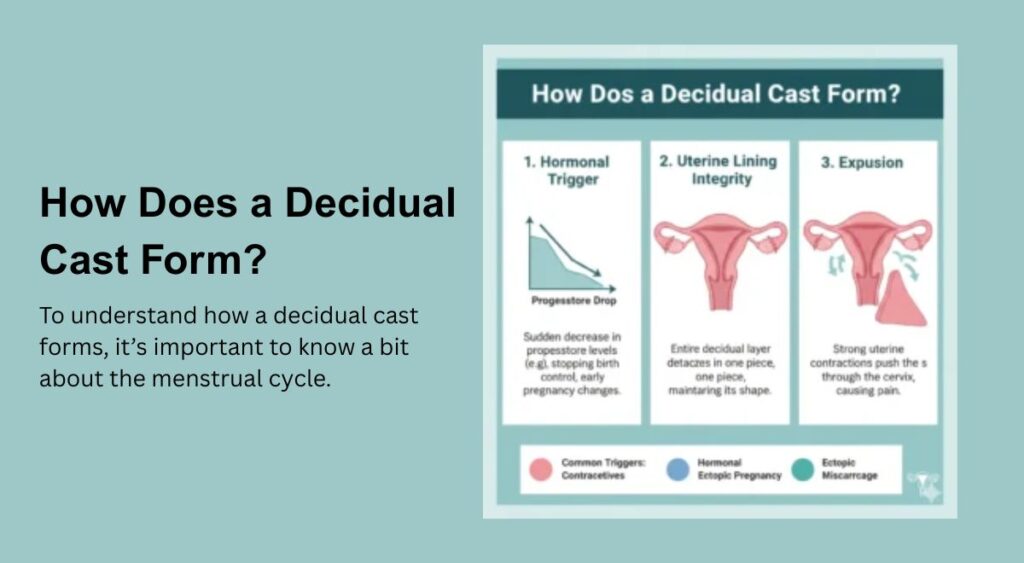How Does a Decidual Cast Form?