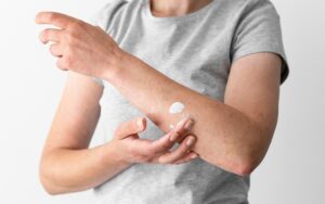 How Reapplying Lotion Helps Skin That Keeps Feeling Irritated