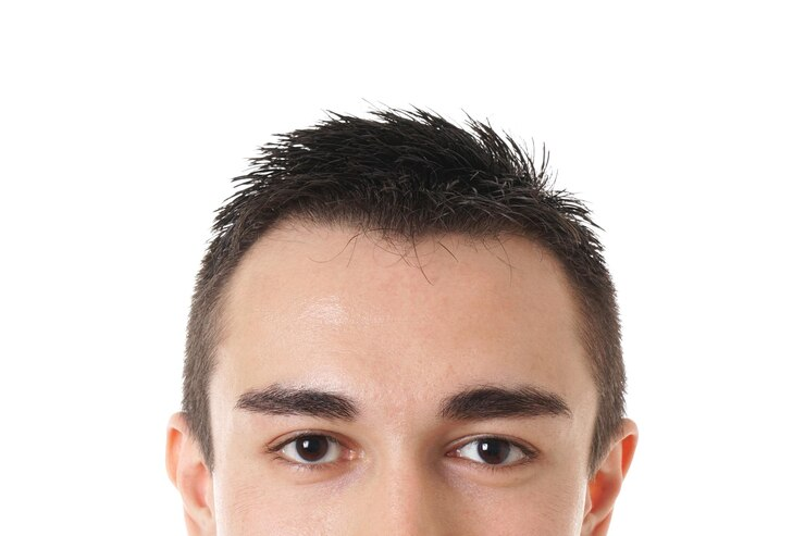 Forehead Reduction Surgery