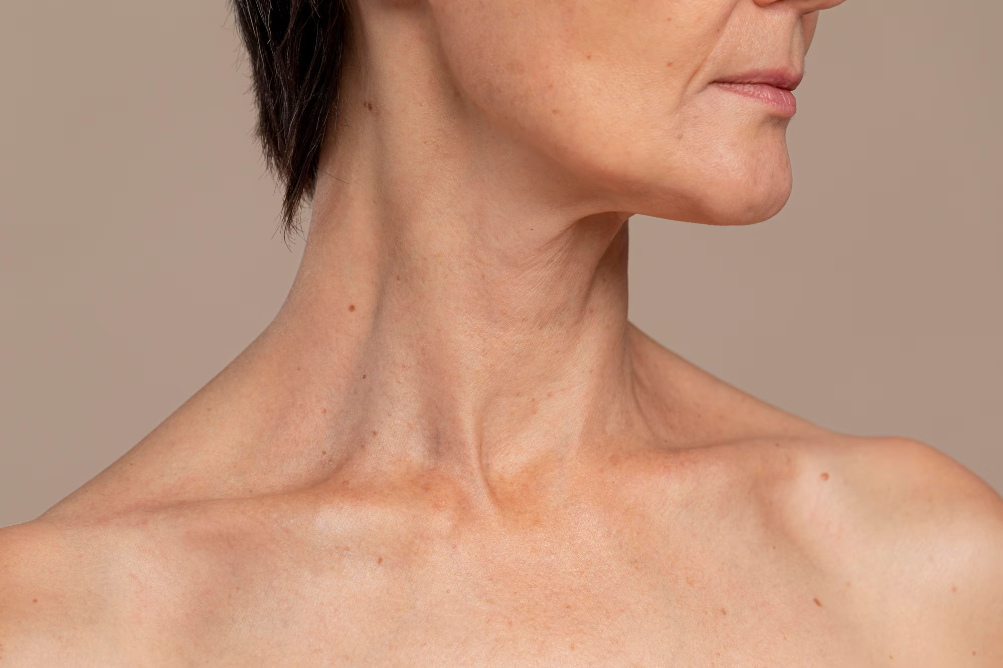 Turkey Neck