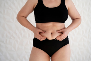 Abdominal Skin